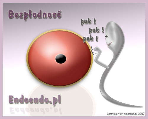 Leczenie bezpłodności związane z endometriozą